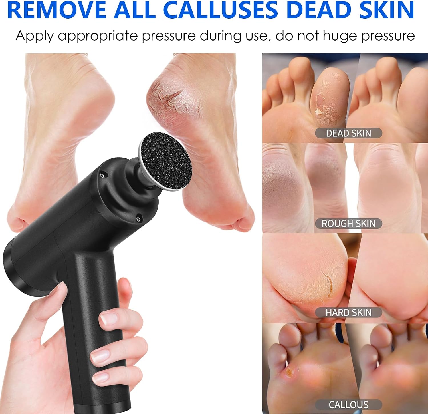 I·b·n G Fcr-3 Electric Callus Remover
