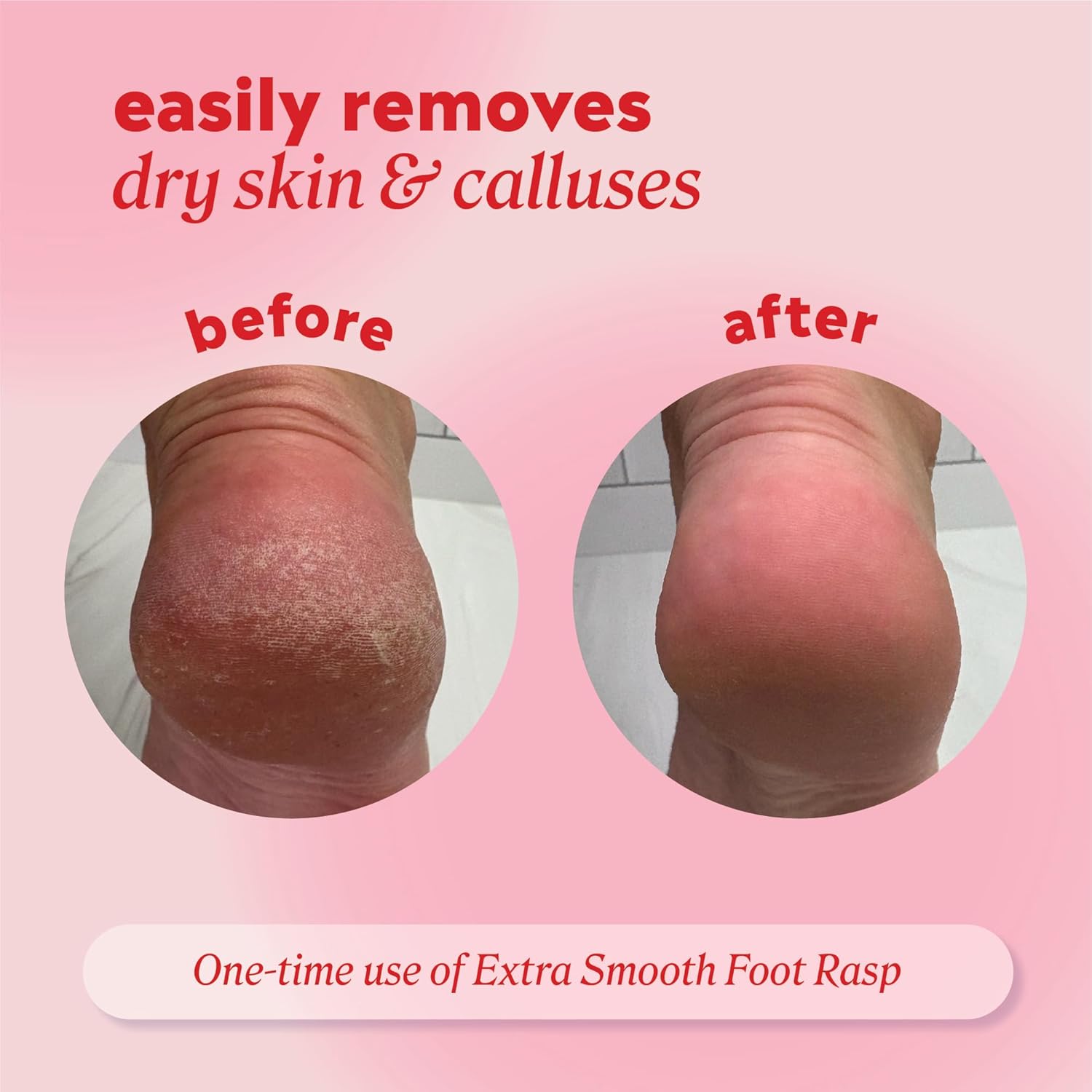 Build quality and the practical design of the callus remover.
