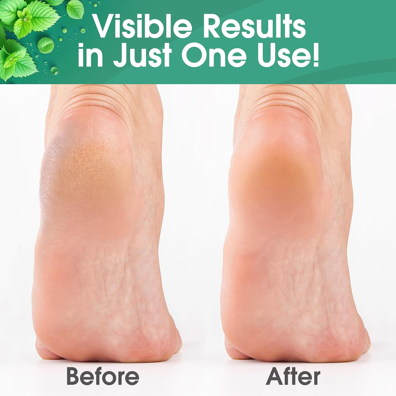 Supports the stainless steel construction and the practical design of the exfoliating tools.
