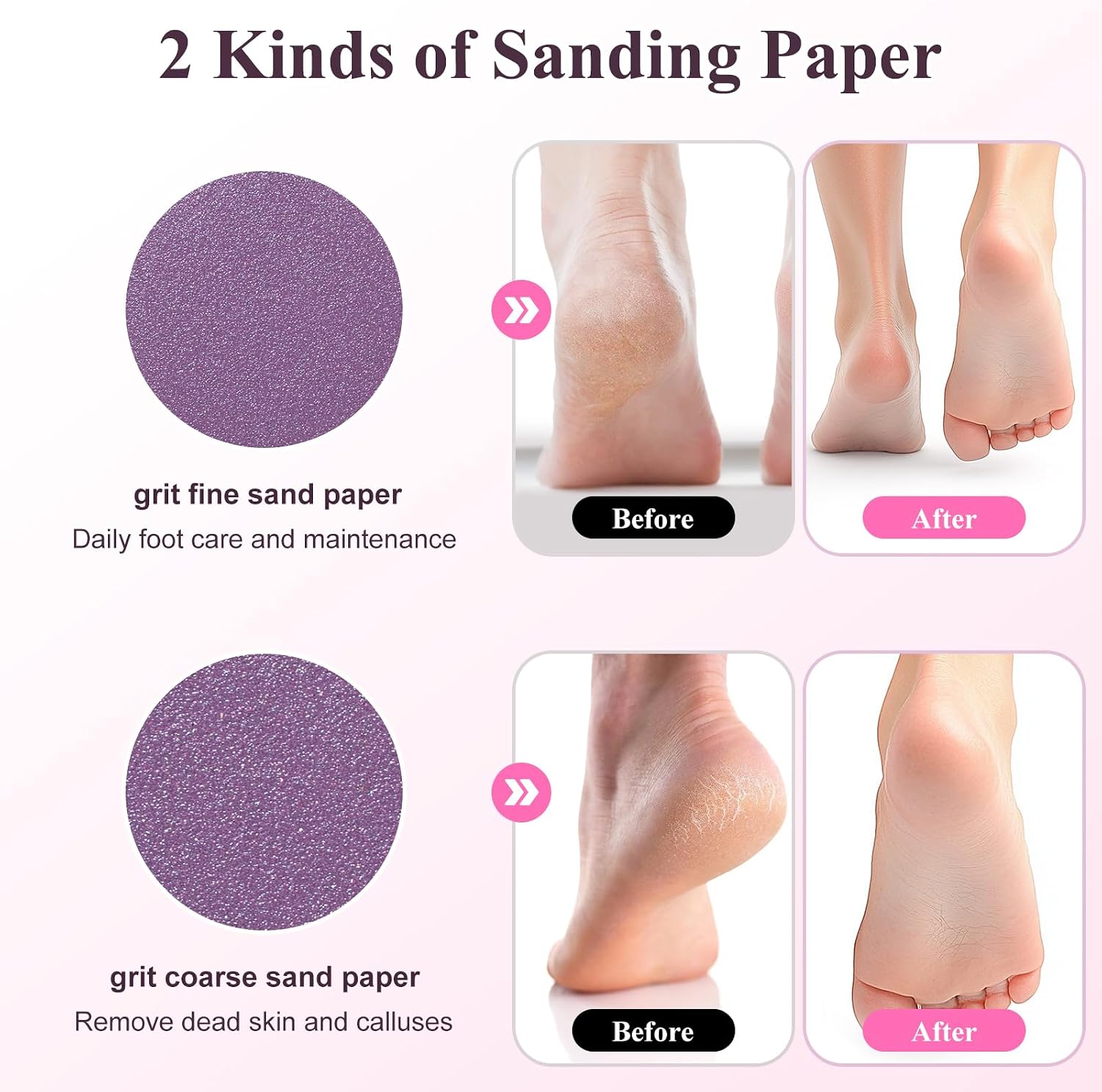 Incamity Electric Callus Remover