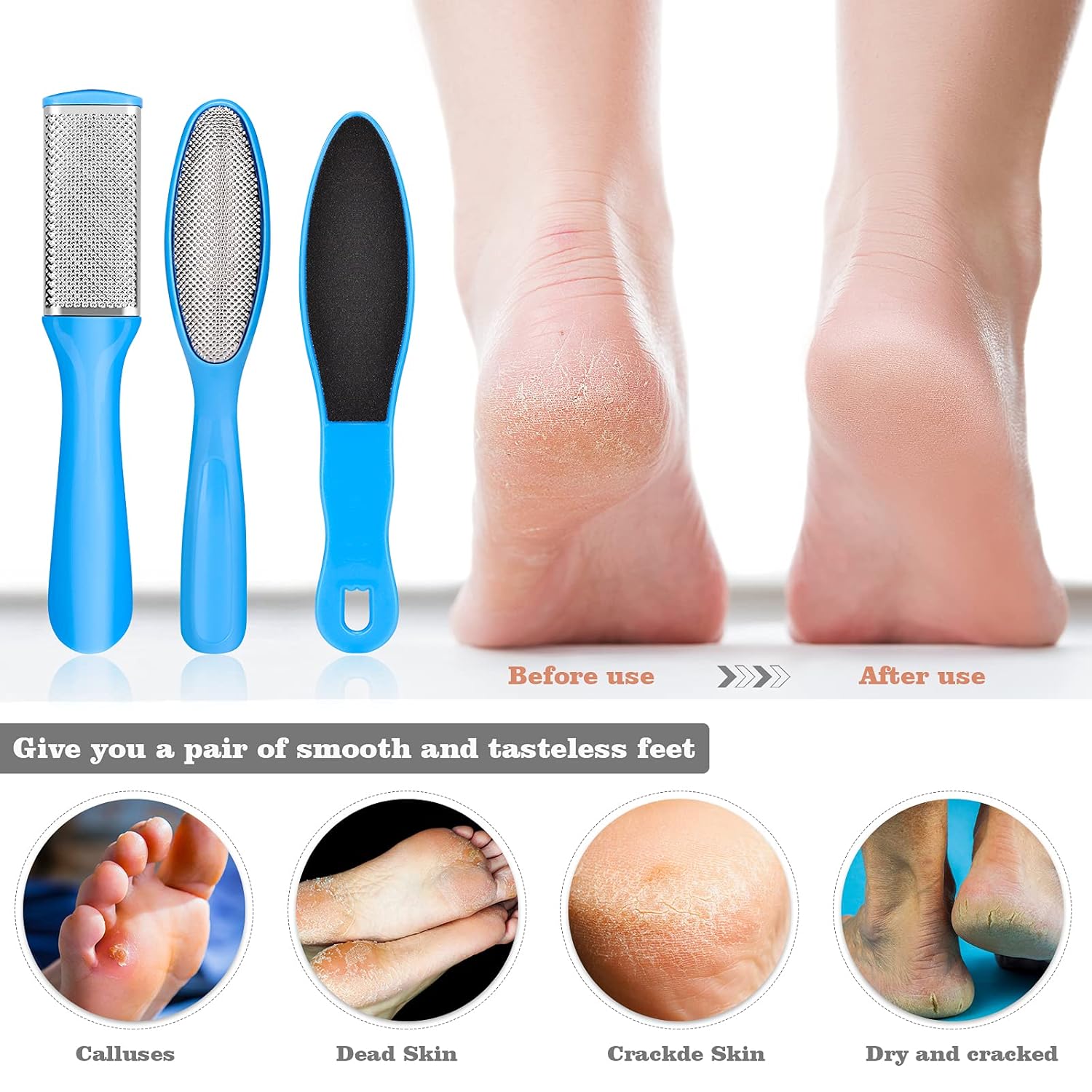 Fintozer 23-Em-1 Kit de Pedicure