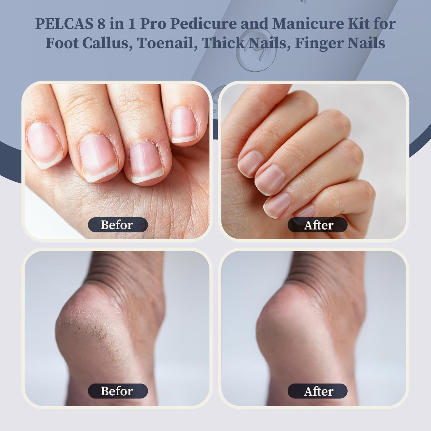 Pelcas Electric Nail Filer
